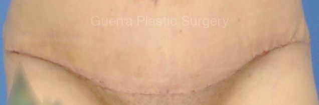 prev Case #4207 Before