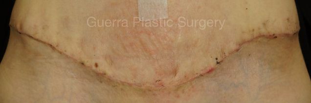 prev Case #4208 Before
