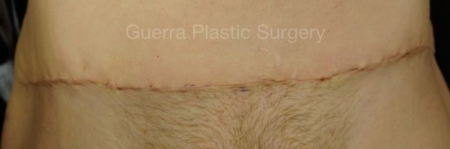 next Case #4210 Before