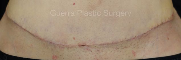 prev Case #4212 Before