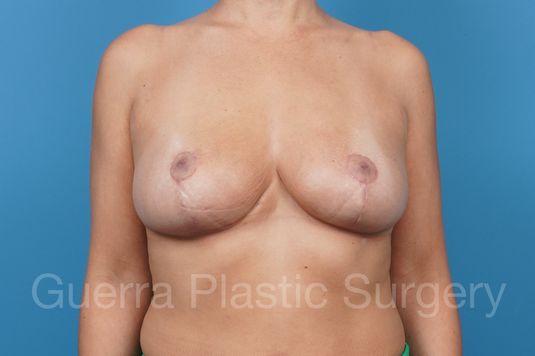 prev Case #24307 After