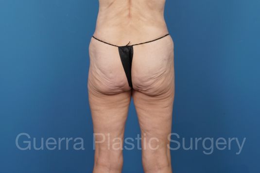 prev Case #34686 Before