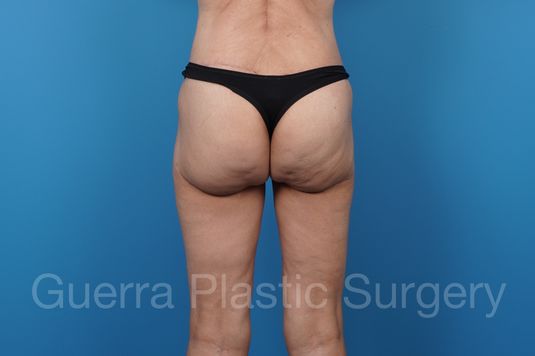 prev Case #34686 After
