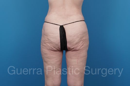Case #21809 Before