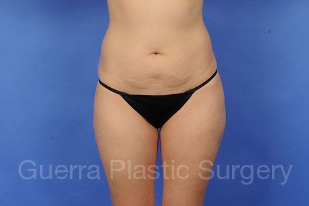 next Case #7208 Before