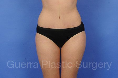 next Case #7208 After