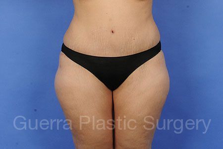 next Case #6378 After