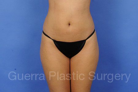 prev Case #93332 Before
