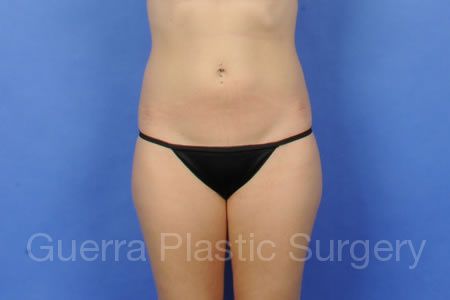 next Case #30956 Before