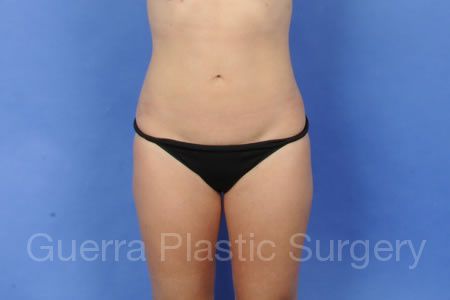 next Case #30956 After