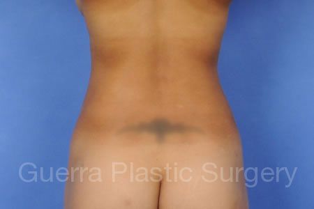 prev Case #405672 After