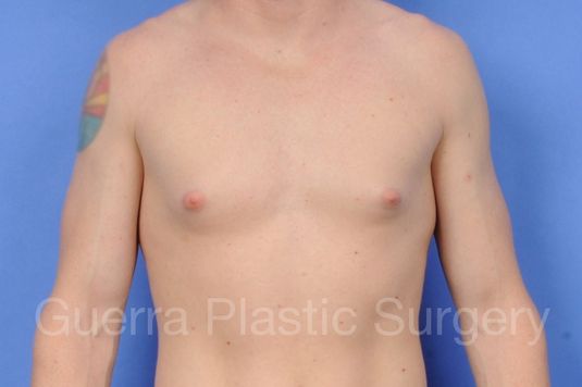 Case #58376 Before