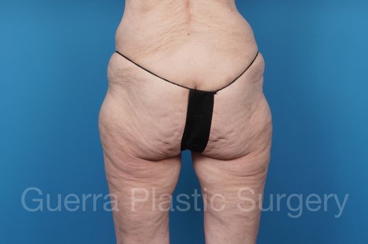prev Case #39777 Before