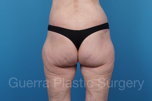 prev Case #39777 After