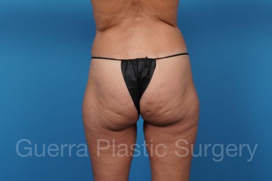 prev Case #40137 Before