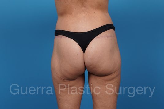prev Case #40137 After