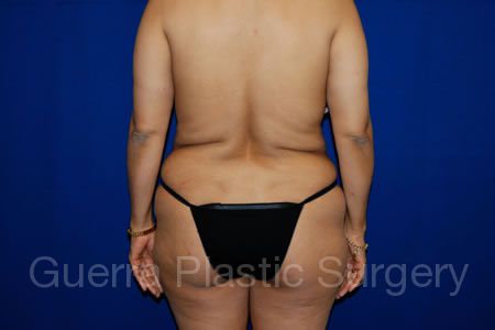 next Case #13369 Before