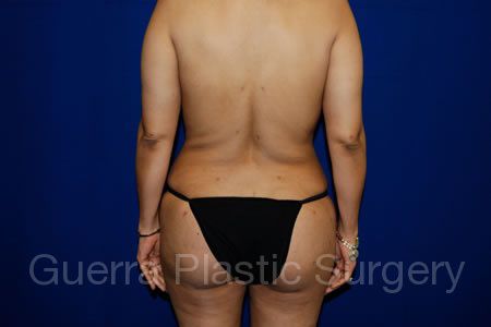 next Case #13369 After