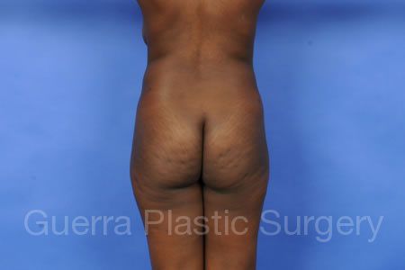 Case #36019 Before