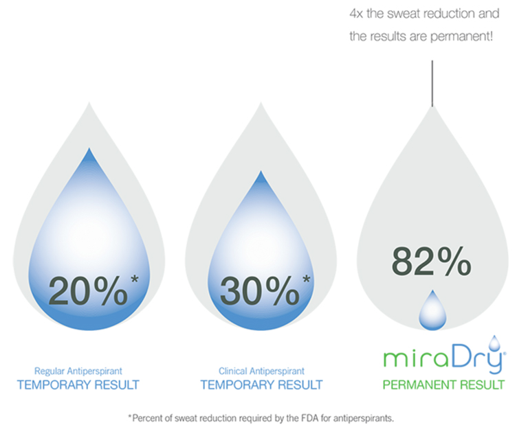 miraDry sweat reduction