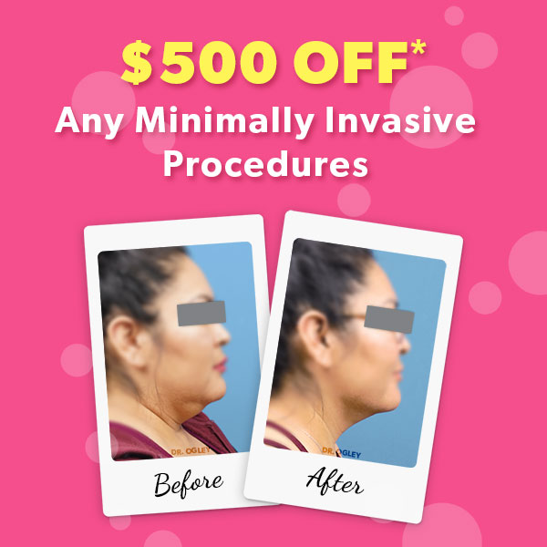$500 off select minimally invasive procedures